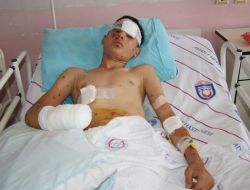 Polise Atacağı Bomba Patlayınca Sağ Eli Koptu