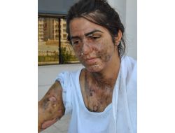 Kıskanç Koca Eşini Asitle Yakıp, Boğmak İstedi