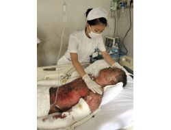 Çin’de Çift Katlı Otobüs Yandı 41 Kişi Öldü