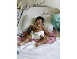 1 Yaşındaki Bebek Babasının Karaciğeriyle Hayata Tutundu