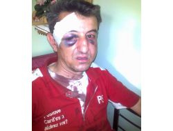 Polis Memuru, ‘korna Çalma’ Diye Uyaran Pompacıyı Darp Etti