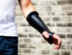 Kırık Kolun İyileşme Sürecini Takip Eden ‘akıllı Alçı’ Geliştirildi