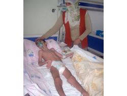 Sspe Hastalarına Evde Tedavi Umudu