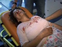 Koca Şiddeti Bayram Günü Hastanelik Etti