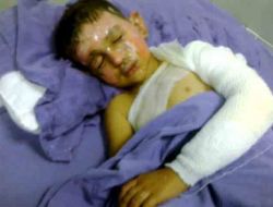 Terör Örgütü Yandaşlarının Yaktığı 6 Yaşındaki Sedat’ın Tedavisi Sürüyor