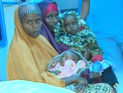 Somalili 14 Çocuk Tedavi Amacıyla İstanbul’a Getirildi