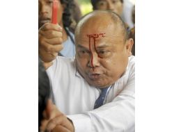 Yolsuzluğa Dikkat Çekmek İçin Kamerlar Karşısında Alnını Bıçakla Kesti