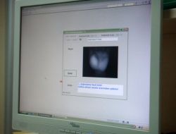 Hayali Muayene, ‘avuç İçi Damarı Okuma’ İle Engellendi