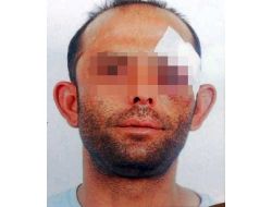 Barışma İsteğini Kabul Etmeyen Eski Kız Arkadaşının Evini Kurşunladı