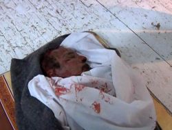 Kaddafi'nin Otopsi Sonrası Görüntüsü