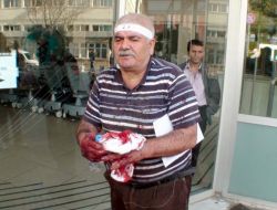 Sadece Acemi Kasaplar Kendini Kesmedi