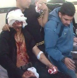 Bağdat'ta Ölü Sayısı  147 Oldu!