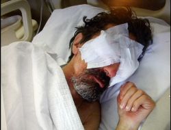 Gözleri Oyulan Hastanın Ailesi, Sağlık Bakanlığı'na Tazminat Davası Açtı