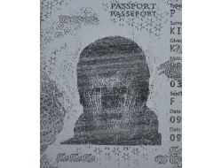 Türkiye’ye Gelir Gelmez Rahatsızlanan İngiliz, Organları İle 3 Kişiye Umut Oldu