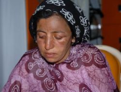 Çadır Yangınında Yaralanan Anne İle Kızı Diyarbakır'a Sevk Edildi