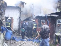 Sigara Önce Bacağına Sonra Hayatına Mal Oldu