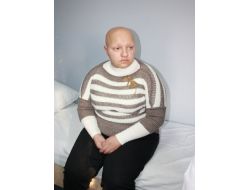 Depremde Dökülen Saçları 12 Yıldır Geri Gelmedi