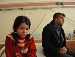 Güneşte Kanser Olan Karanlığın Çocukları Gün Işığını Bekliyor