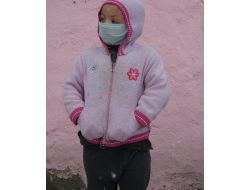 5 Yaşındaki Hasret Tedavi Edilmezse Diğer Gözünü De Kaybedecek