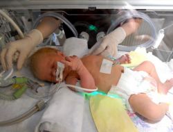 8 Bebek Elektrik Arızası Sebebiyle Öldü