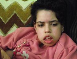 Engelli Mukaddes'in Ailesi Tedavi İçin Yardım Bekiliyor