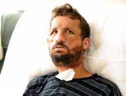 İşte Türkiye'nin İlk Yüz Nakli