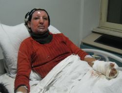 Doğubayazıt'ta Tüp Patladı: 2 Yaralı