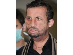 Uğur Acar, basının karşısında!..