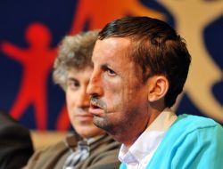 İlk Yüz Naklinin Faturası 250 Bin Lira