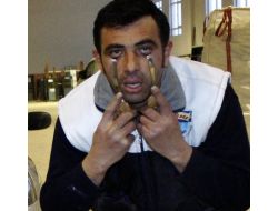 Göz Çukurlarıyla 1 Ton 200 Kiloluk Arabayı Çekti