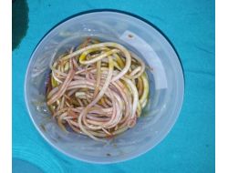 3 Yaşındaki Çocuğun Bağırsağından 2 Kilo Parazit Solucan Çıkarıldı