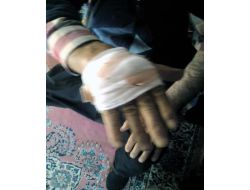 Eşeğin Isırdığı Adam Hastanelik Oldu