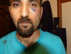 Önce Çekici Şoföründen, Sonra 15 Polisten Dayak Yedi