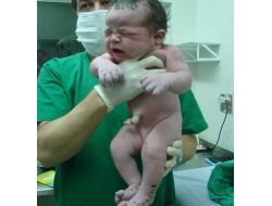 Brezilya’da 5,2 Kilo Ağırlığında Bebek