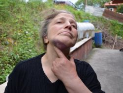 Anneler Günü'nde, Öz Annesini Yaralayan Genç, Tutuklandı