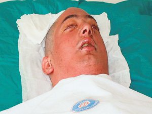 Turan Çolak, yeni yüzüyle görüntülendi!