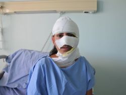 Yüzüne Asit Döken Saldırganları Tanımıyor