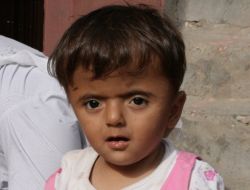 Kafası Sürekli Büyüyor