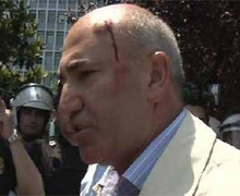 CHP'li vekil başından yaralandı