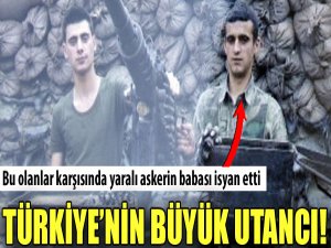 Yaralı askeri otobüsle gönderdiler