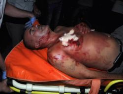 Sigara İstediler, 'Yok' Cevabını Alınca Bıçakladılar