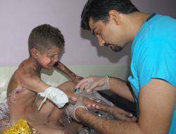 Elektrik Akımına Kapılan Çocuk Yaralandı