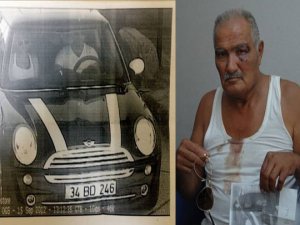 Ünlü popçu bu hale getirdi!