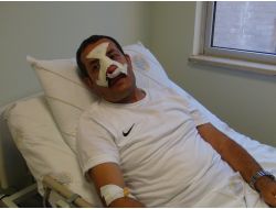 Öğrenci Velisi, Okul İdarecisinin Burnunu Kırdı