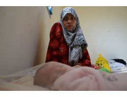 Anne Karnında Savaşla Tanışan Suriyeli İkizlerin Öyküsü