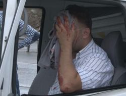 Kaza Yapan Sürücü, Uzun Süre Kurtarılmayı Bekledi (Özel)