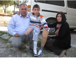 Doktorlar 'Hastaneden Koşarak Çıkacak' Dedi, Ayağı Kesildi