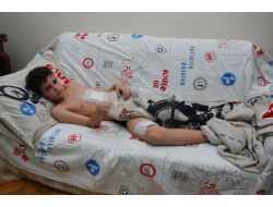 Pitbullun Saldırdığı Çocuk, Yaralı Kurtuldu