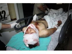 Polise Atmak İstediği Bomba Elinde Patlayan Çocuğa 15 Yıl Hapis Cezası