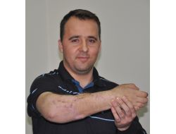 Kopan Kolunu Diken Doktorlarıyla Tokalaştı